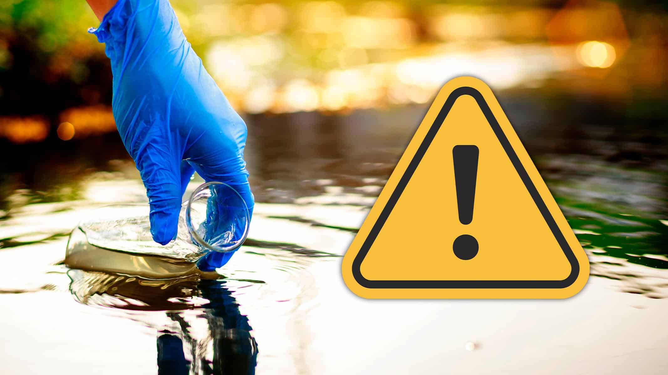 Brote de Hepatitis en Matanzas: Crisis Sanitaria en Cárdenas por Agua Contaminada
