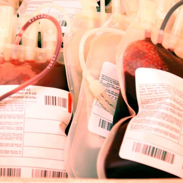 Informan Situación Actual de Donaciones de Sangre en Cuba