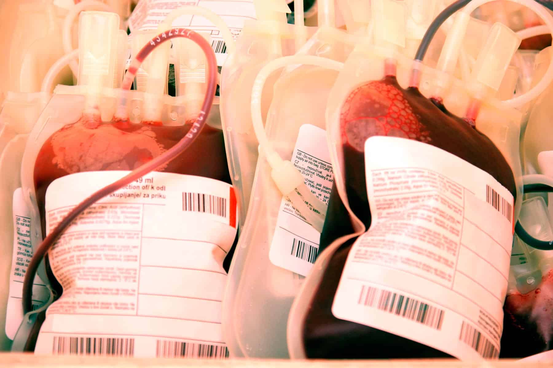 Informan Situación Actual de Donaciones de Sangre en Cuba