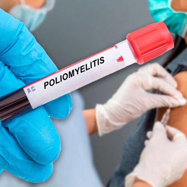 Inicia Ensayo Clínico Sobre la Poliomielitis en Provincia Cubana