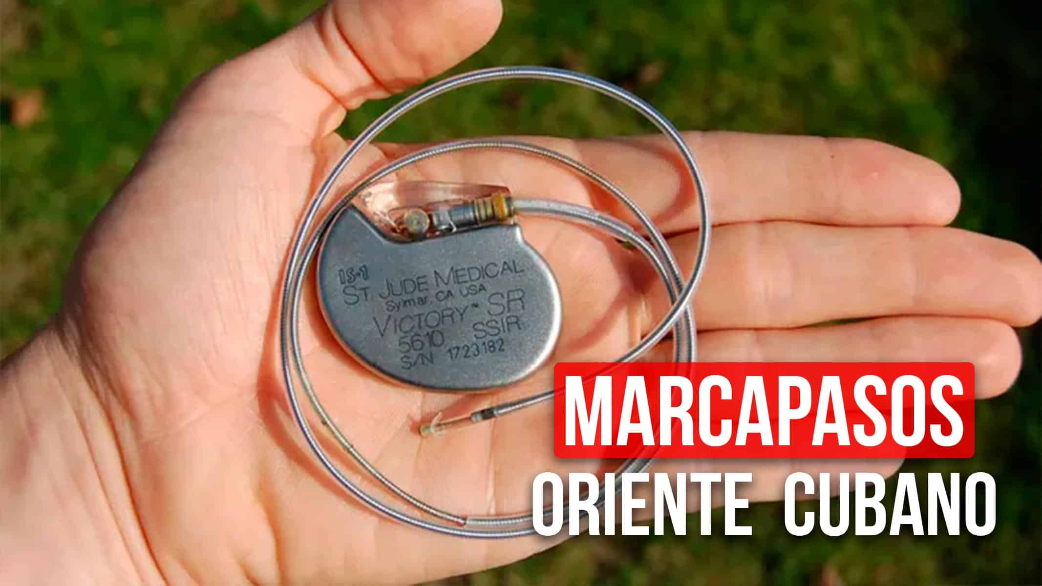 Marcapasos Para el Oriente Cubano: Estarán Disponibles en Este Centro de Salud