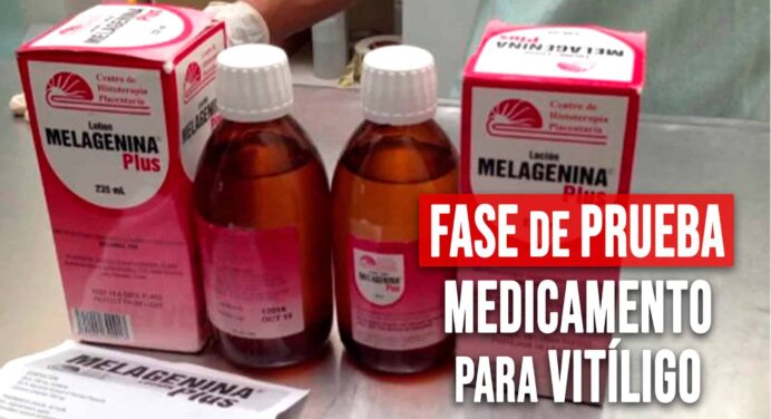 Medicamento Cubano para el Vitíligo se Encuentra en Fase de Prueba