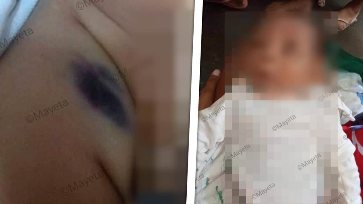Muere Bebé de 2 Meses Tras Acudir Dos Veces al Hospital en un Mismo Día: Investigan el Caso en Cuba