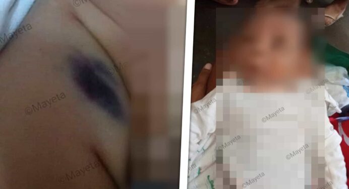 Muere Bebé de 2 Meses Tras Acudir Dos Veces al Hospital en un Mismo Día: Investigan el Caso en Cuba