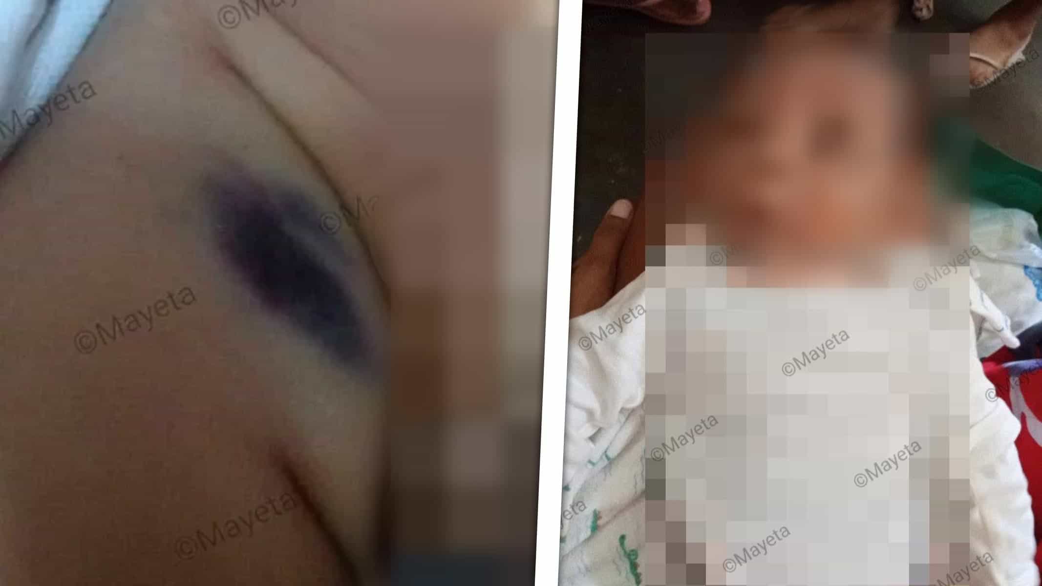 Muere Bebé de 2 Meses Tras Acudir Dos Veces al Hospital en un Mismo Día: Investigan el Caso en Cuba