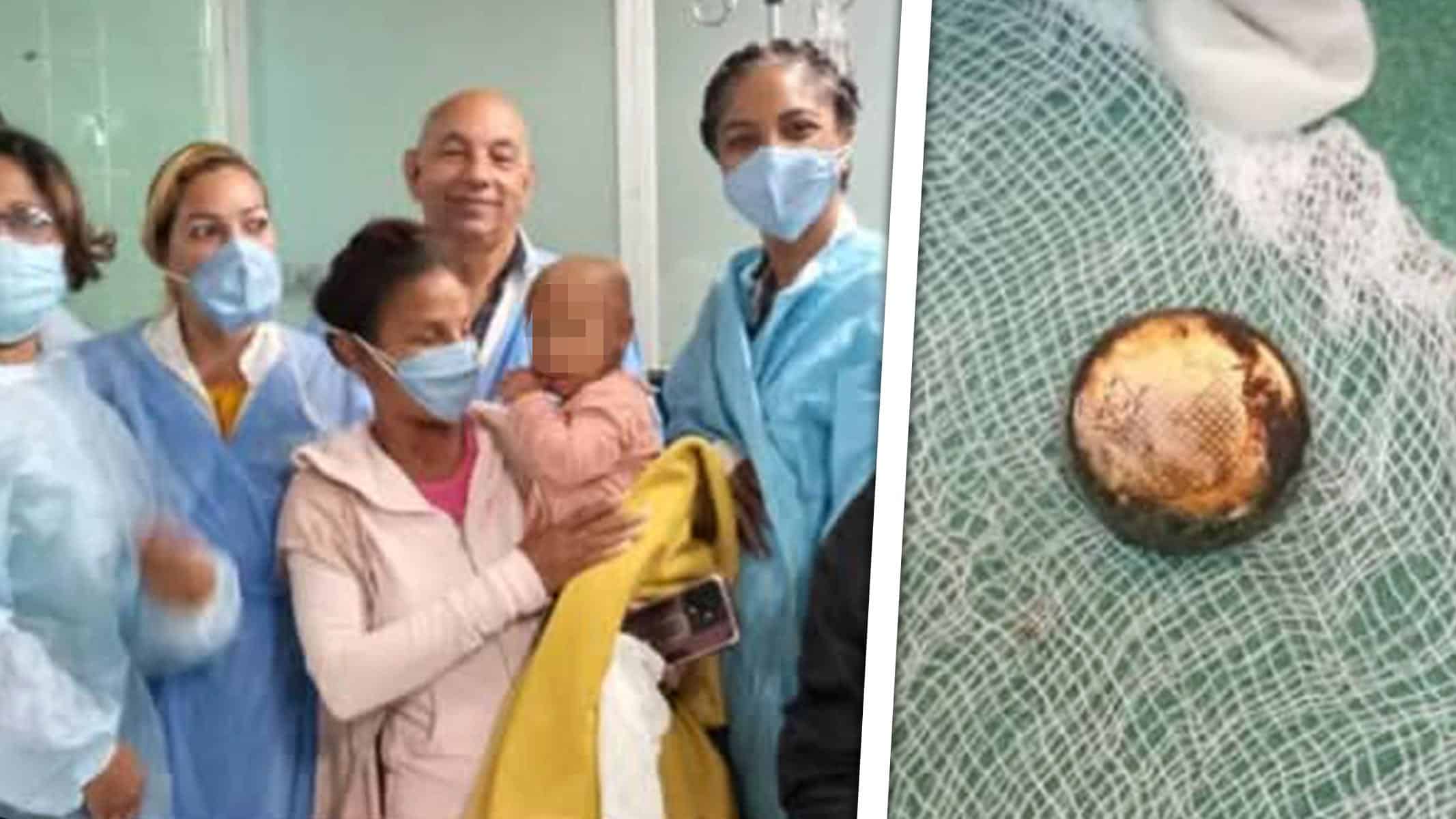 Niña Cubana Operada Para Extraer Batería de Litio de su Esófago: Así Evoluciona