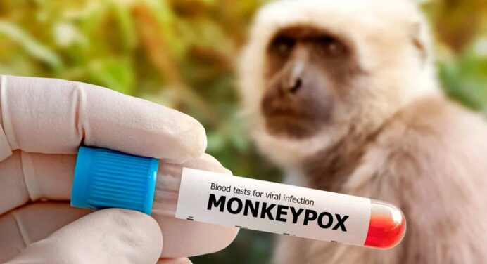 Viruela del mono: la OMS declara Emergencia de Salud