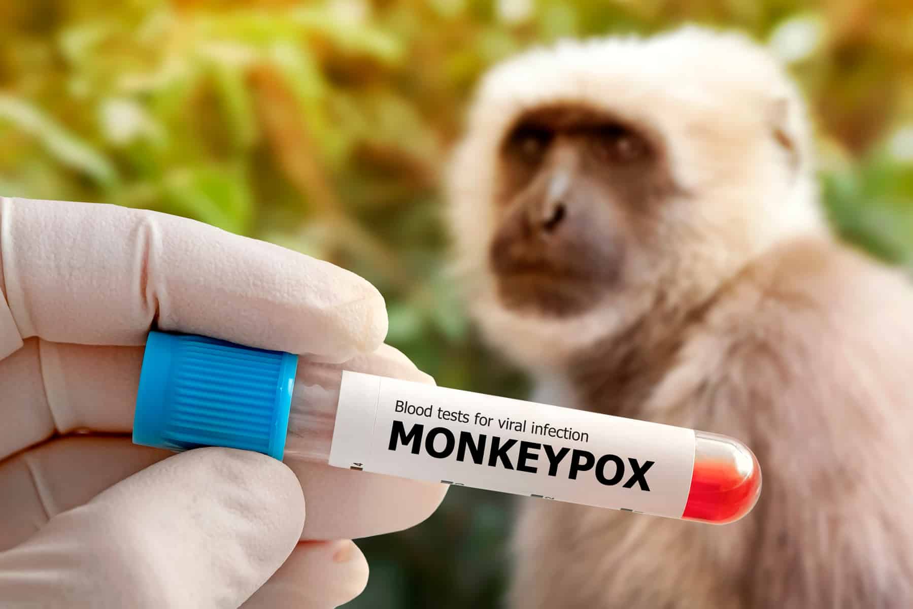 Viruela del mono la OMS declara Emergencia de Salud