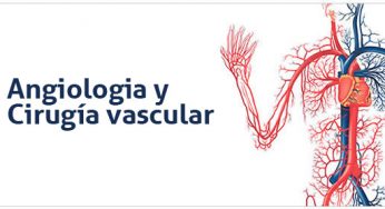 Instituto de Angiología y Cirugía Vascular en Cuba